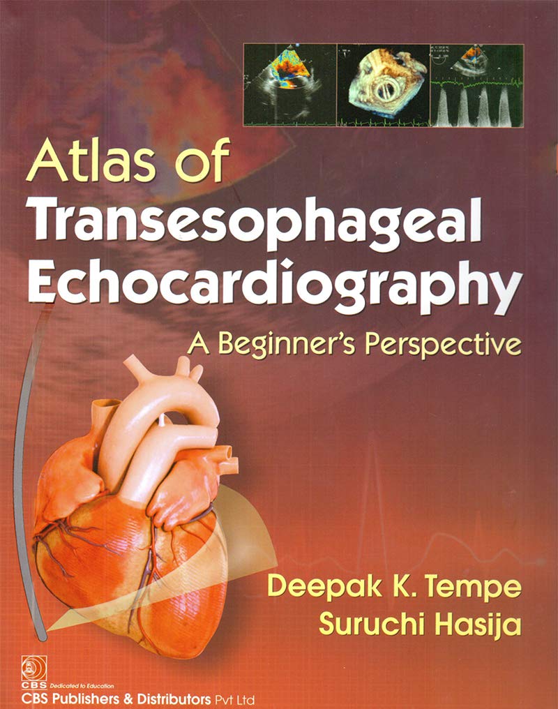 Atlas of Transesophageal Echocardiography A Beginner’s Perspective: A Beginners Perspective, 2nd Edition (EPUB)