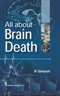 All About Brain Death (EPUB)