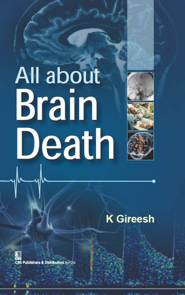 All About Brain Death (EPUB)