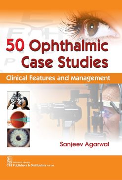 50 Ophthalmic Case Studies Clinical Features and Management (Original PDF from Publisher)