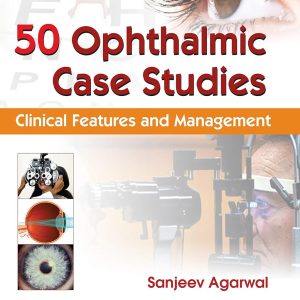 50 Ophthalmic Case Studies Clinical Features and Management (Original PDF from Publisher)