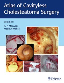 Atlas of Cavityless Cholesteatoma Surgery (Volume 2) (Original PDF from Publisher)