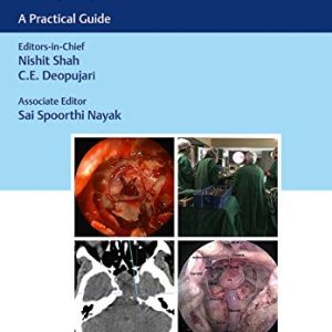 Endoscopic Transsphenoidal Surgery: A Practical Guide (Original PDF from Publisher+Videos)