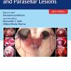 Atlas of Sellar, Suprasellar, and Parasellar Lesions (Original PDF from Publisher+Videos)