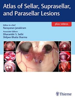 Atlas of Sellar, Suprasellar, and Parasellar Lesions (Original PDF from Publisher+Videos)