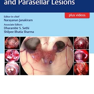 Atlas of Sellar, Suprasellar, and Parasellar Lesions (Original PDF from Publisher+Videos)