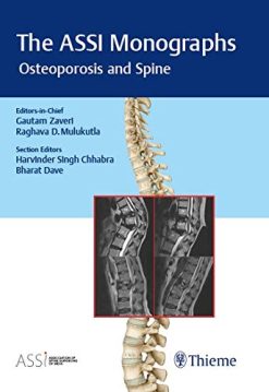 The ASSI Monographs – Osteoporosis and Spine (Original PDF from Publisher)