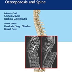The ASSI Monographs – Osteoporosis and Spine (Original PDF from Publisher)