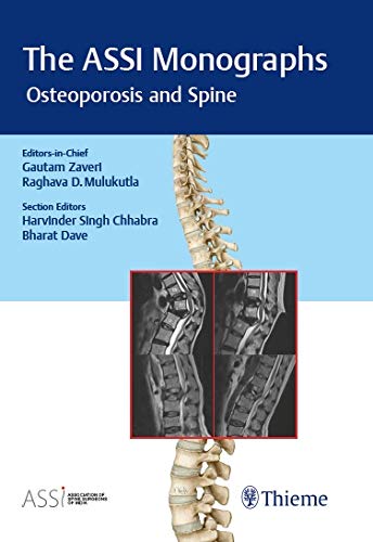 The ASSI Monographs – Osteoporosis and Spine (Original PDF from Publisher)