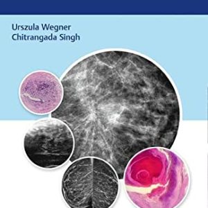 Breast Cancer Mimics (Original PDF from Publisher)