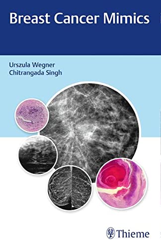 Breast Cancer Mimics (Original PDF from Publisher)