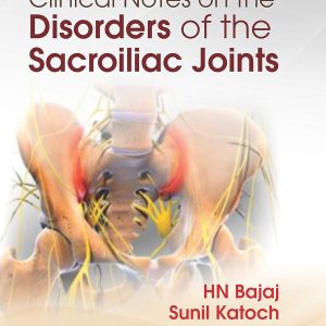 Clinical Notes on the Disorders of Sacroiliac Joints (Original PDF from Publisher)