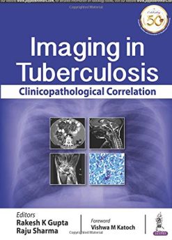 Imaging in Tuberculosis: Clinicopathological Correlation (Original PDF from Publisher)