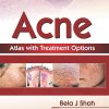 Acne Atlas with Treatment Options (Original PDF from Publisher)
