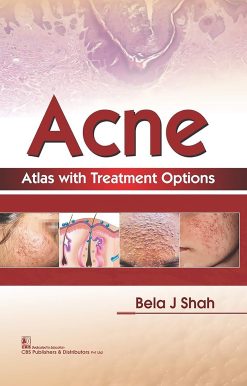 Acne Atlas with Treatment Options (Original PDF from Publisher)