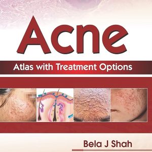 Acne Atlas with Treatment Options (Original PDF from Publisher)
