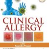 Clinical Allergy (Original PDF from Publisher)