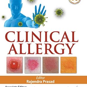 Clinical Allergy (Original PDF from Publisher)