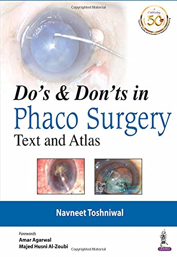 Do’s & Dont’s in Phaco Surgery: Text and Atlas (Original PDF from Publisher)