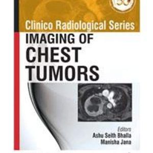 Clinico Radiological Series: Imaging of Chest Tumors (Original PDF from Publisher)
