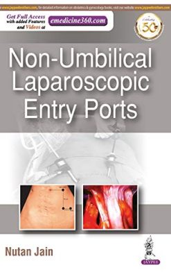 Non-Umbilical Laparoscopic Entry Ports (Original PDF from Publisher)