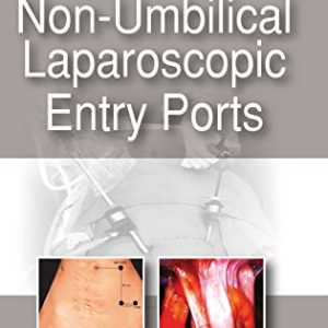 Non-Umbilical Laparoscopic Entry Ports (Original PDF from Publisher)