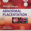 FOGSI Focus Abnormal Placentation (Original PDF from Publisher)