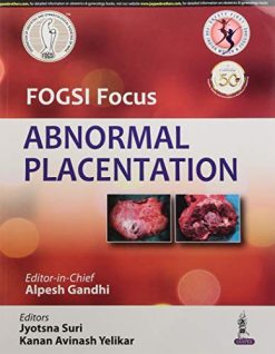 FOGSI Focus Abnormal Placentation (Original PDF from Publisher)