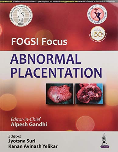 FOGSI Focus Abnormal Placentation (Original PDF from Publisher)