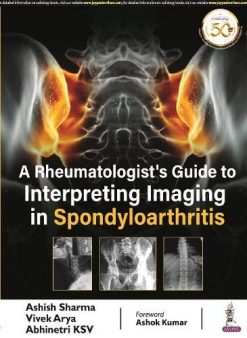 A Rheumatologist’s Guide to Interpreting Imaging in Spondyloarthritis (Original PDF from Publisher)