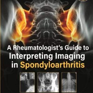 A Rheumatologist’s Guide to Interpreting Imaging in Spondyloarthritis (Original PDF from Publisher)