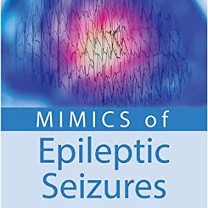 Mimics Of Epileptic Seizures (Original PDF from Publisher)
