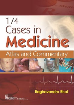 174 cases in Medicine (Original PDF from Publisher)