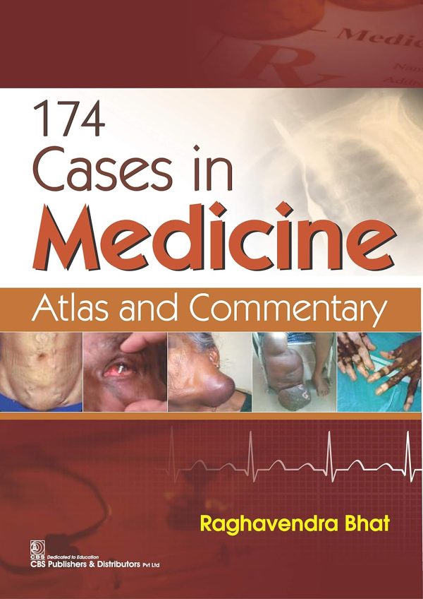 174 cases in Medicine (Original PDF from Publisher)