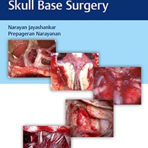 Atlas of 360 degrees Skull Base Surgery (Original PDF from Publisher)