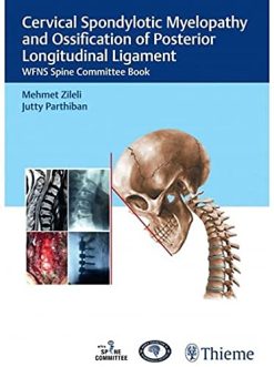 Cervical Spondylotic Myelopathy and Ossification of Posterior Longitudinal Ligament (Original PDF from Publisher)
