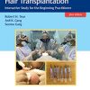 Practical Guide to Hair Transplantation: Interactive Study for the Beginning Practitioner (Original PDF from Publisher+Videos)