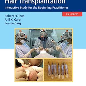 Practical Guide to Hair Transplantation: Interactive Study for the Beginning Practitioner (Original PDF from Publisher+Videos)