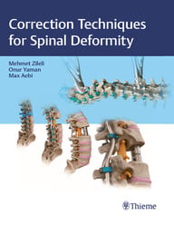 Correction Techniques for Spinal Deformity (Original PDF from Publisher)