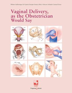 Vaginal Delivery, as the Obstetrician Would Say (Spanish Edition) (EPUB)