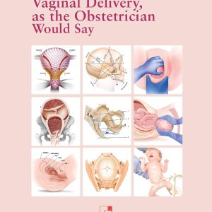 Vaginal Delivery, as the Obstetrician Would Say (Spanish Edition) (EPUB)