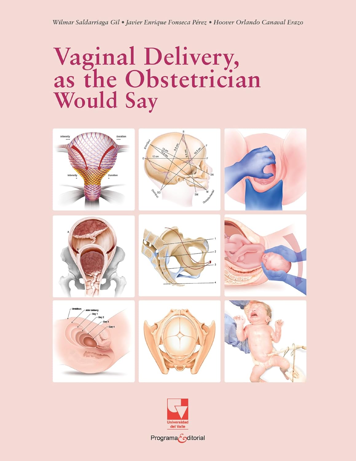 Vaginal Delivery, as the Obstetrician Would Say (Spanish Edition) (EPUB)