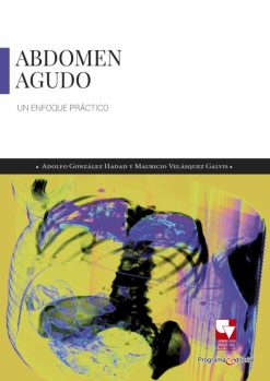 ABDOMEN AGUDO. UN ENFOQUE PRÁCTICO (Original PDF from Publisher)