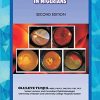 The Atlas of Retinal Diseases in Nigerians (Original PDF from Publisher)