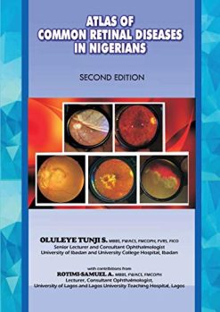 The Atlas of Retinal Diseases in Nigerians (Original PDF from Publisher)