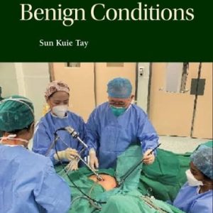 Hysterectomy for Benign Conditions (Original PDF from Publisher)
