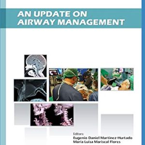 An Update on Airway Management (Recent Advances in Anesthesiology) (Original PDF from Publisher)