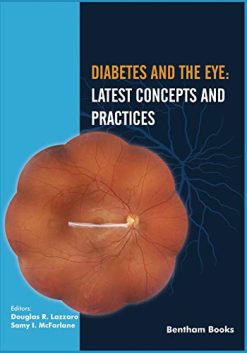 Diabetes and the Eye: Latest Concepts and Practices (Original PDF from Publisher)