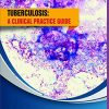 Tuberculosis: a clinical practice guide (Original PDF from Publisher)