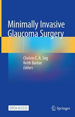 Minimally Invasive Glaucoma Surgery (Original PDF from Publisher)